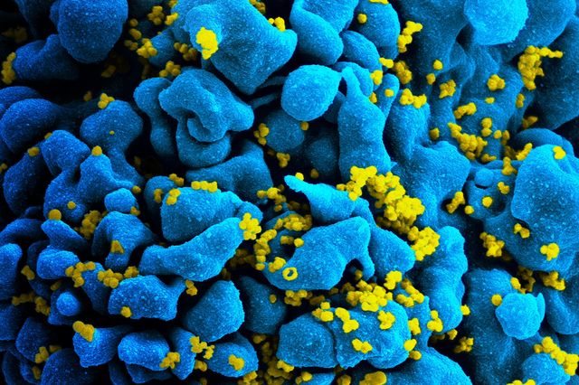 HIV-infected T cell