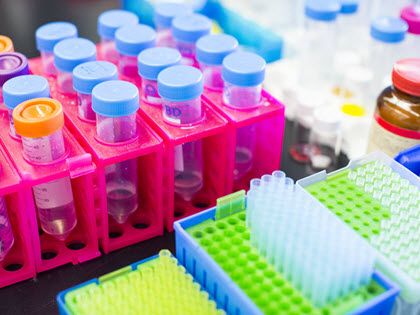 Lab test