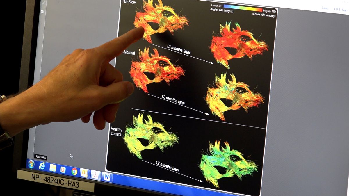 Traumatic brain injury study scans