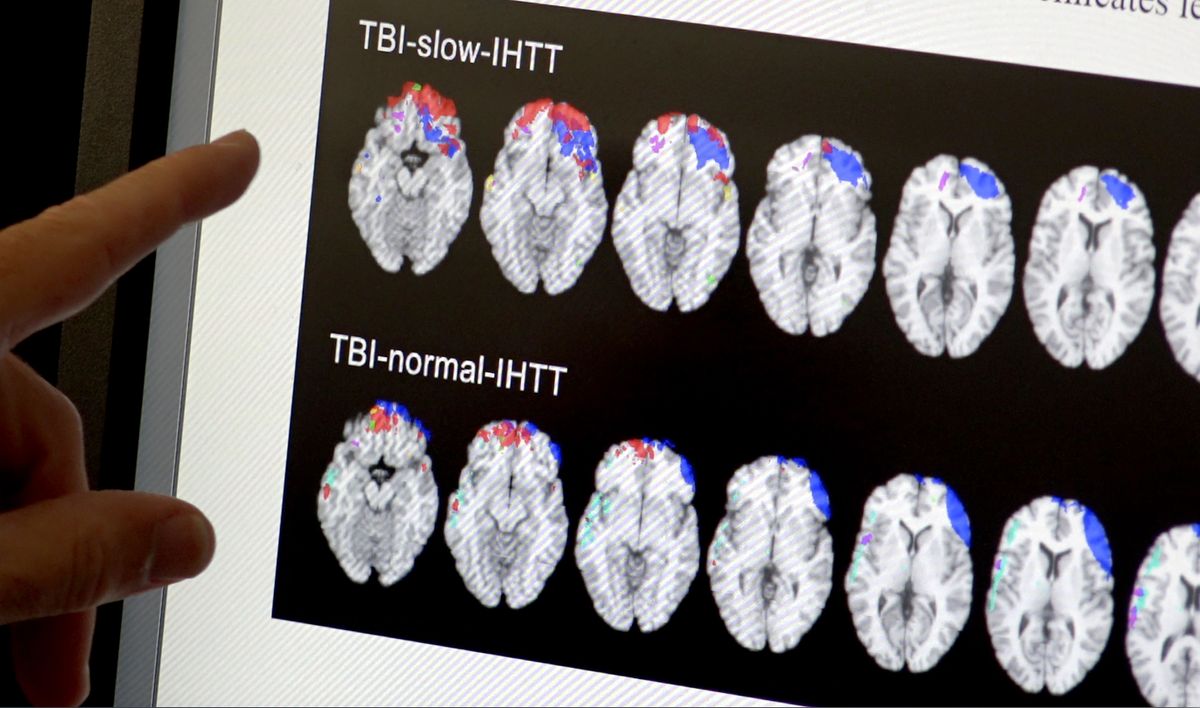 Traumatic brain injury study scans