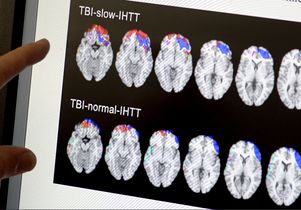 Traumatic brain injury study scans