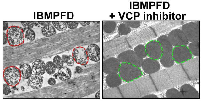 Researchers identify potential treatment for type of muscle and