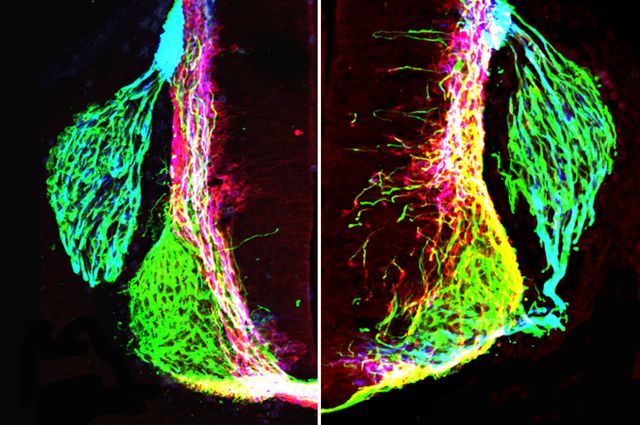 Netrin1 and axon growth