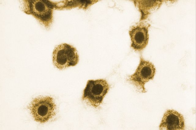 Cytomegalovirus