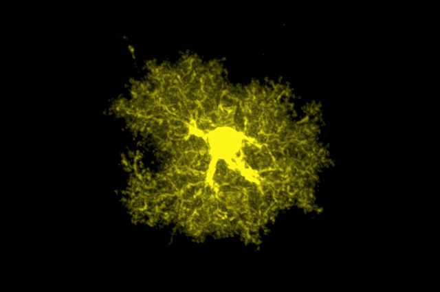 Astrocyte