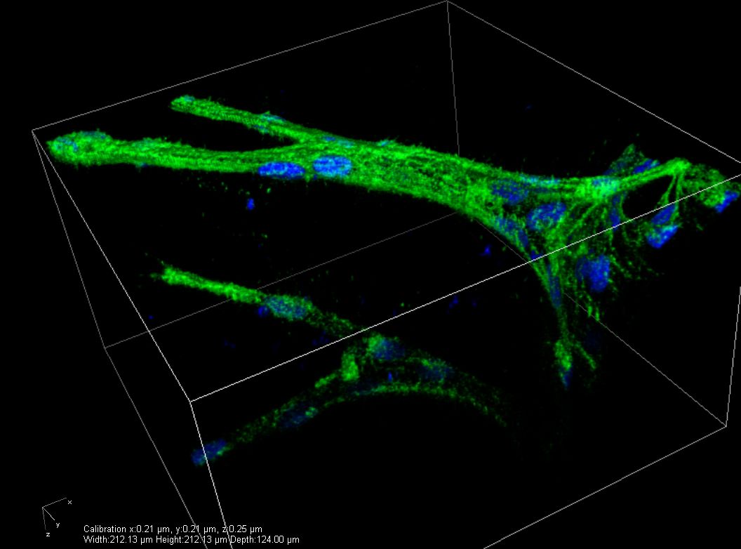 Endothelial cells with preferred integrin