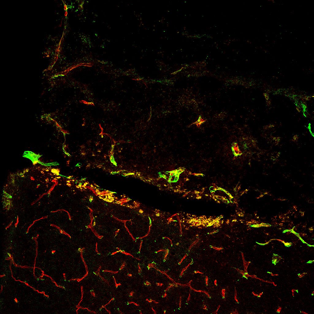 Blood vessels with non-preferred integrin