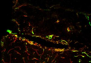 Blood vessels with non-preferred integrin