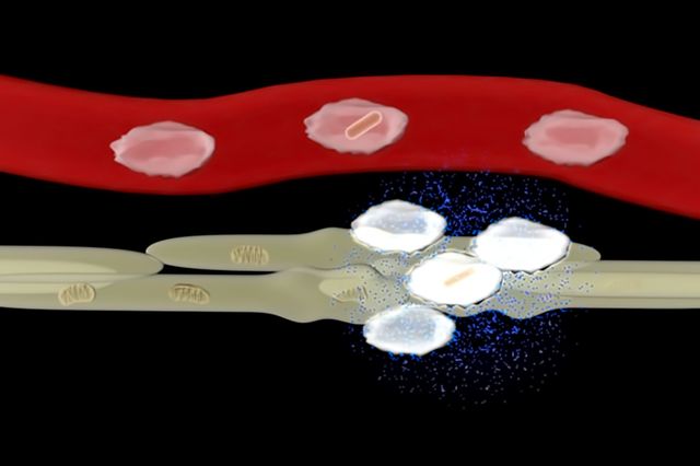 Infected cells damage nerve