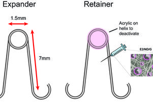 Cleft palate treatment