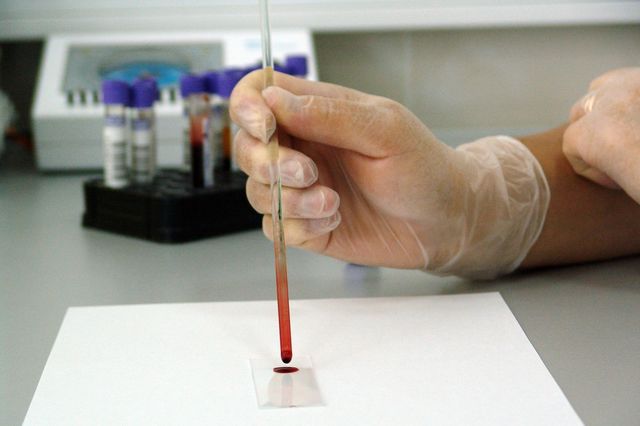 Laboratory blood test