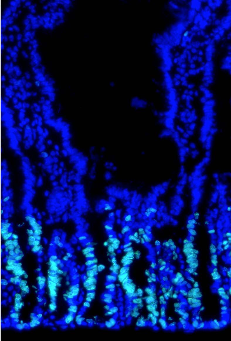 Mouse cells Tontonoz Lab