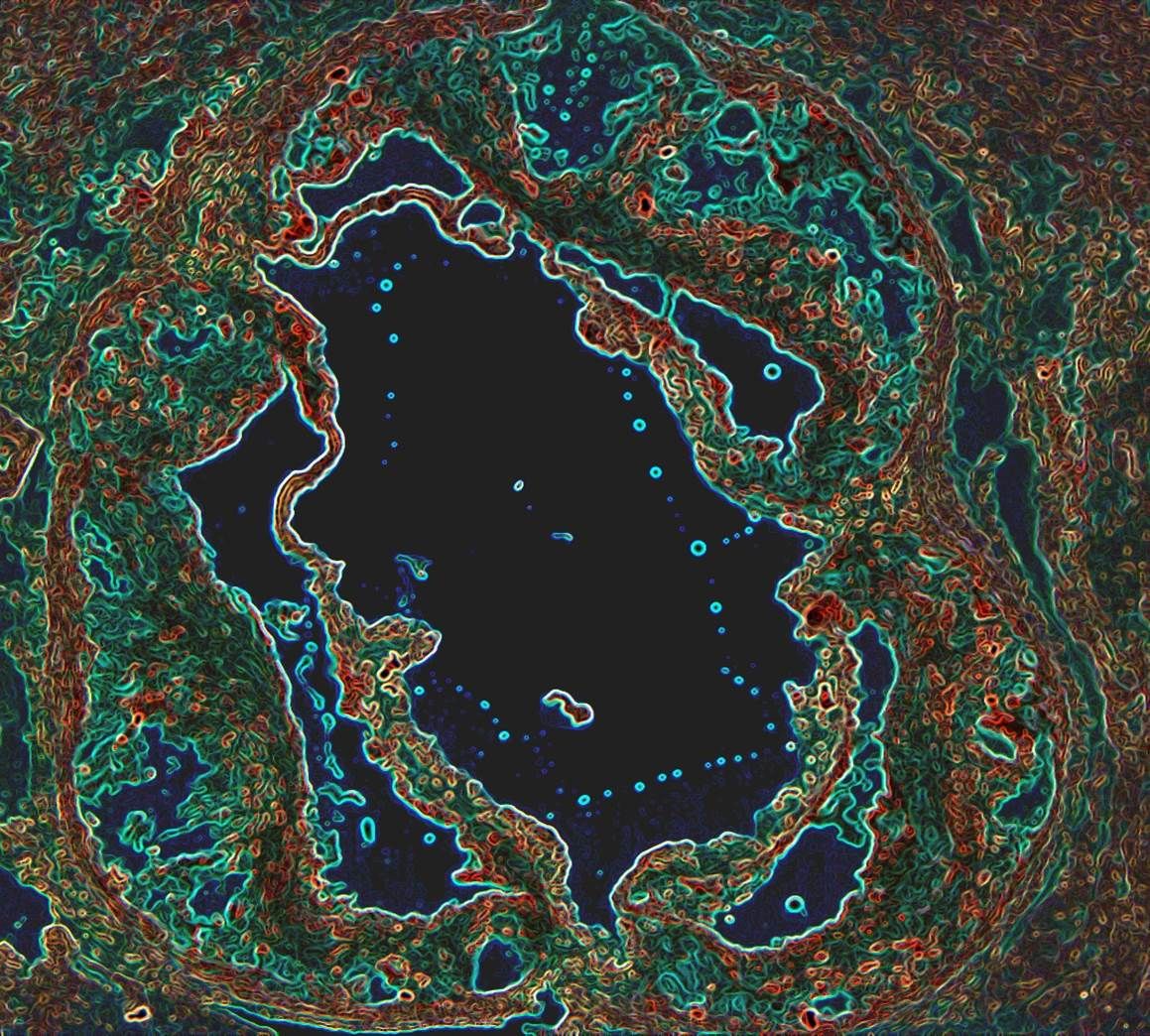 Mouse blood vessel with plaque accumulation
