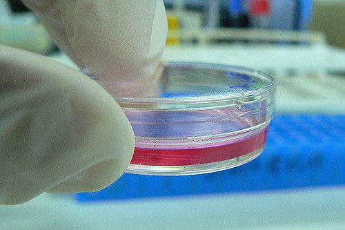 Petri dish