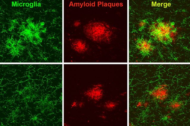 microglia illustration