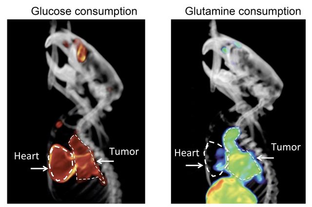 Squamous lung tumors