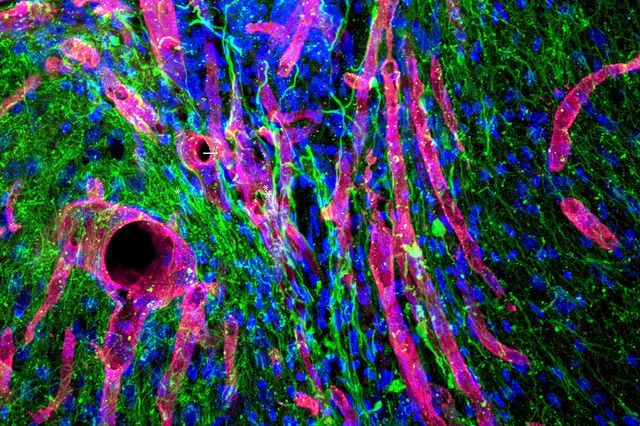 New tissue in brain