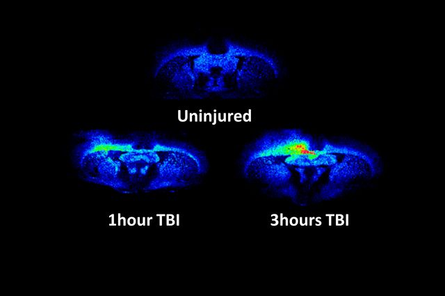 Traumatic brain injury in rats