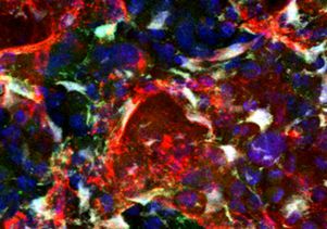 Pleiotrophin in irradiated cells