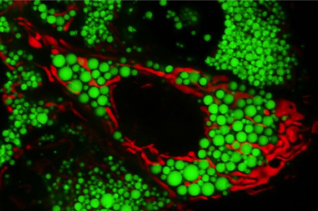 Mitochondria and lipids