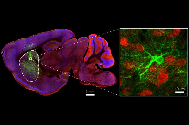 Astrocytes