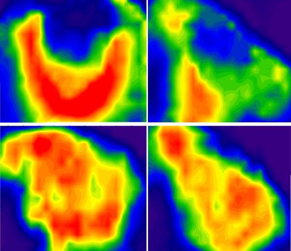 Recovery differences