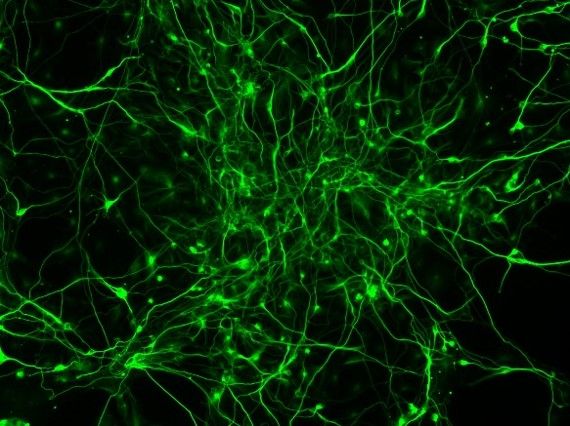 Neurons-in-a-dish