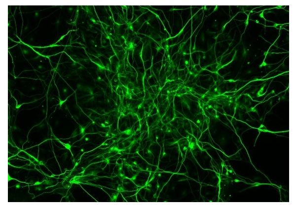 Neurons-in-a-dish