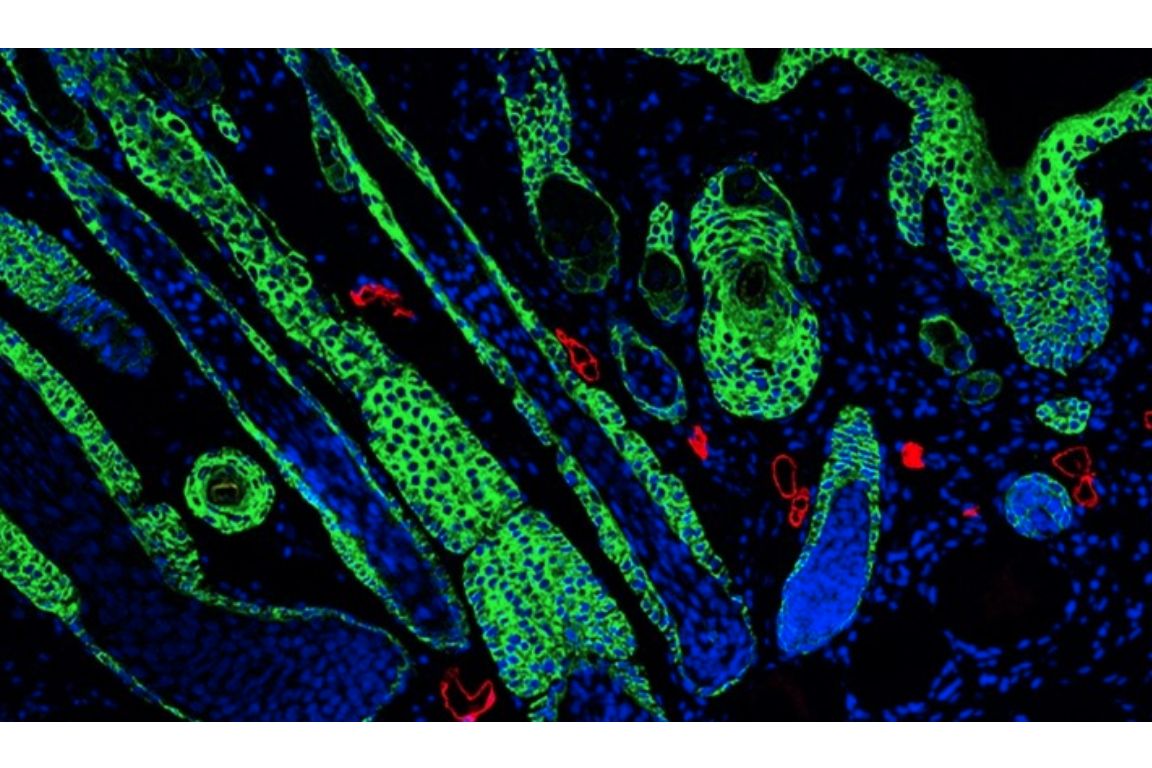 Microscopic image of regenerated hair follicles