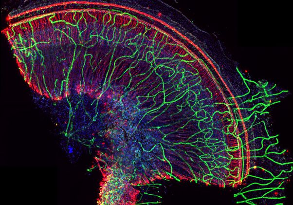 Click to open the large image: Cochlea