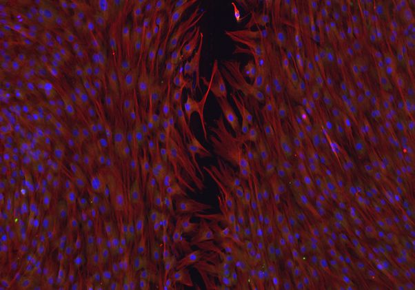 Click to open the large image: Cornea