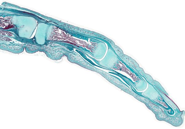 Click to open the large image: Finger