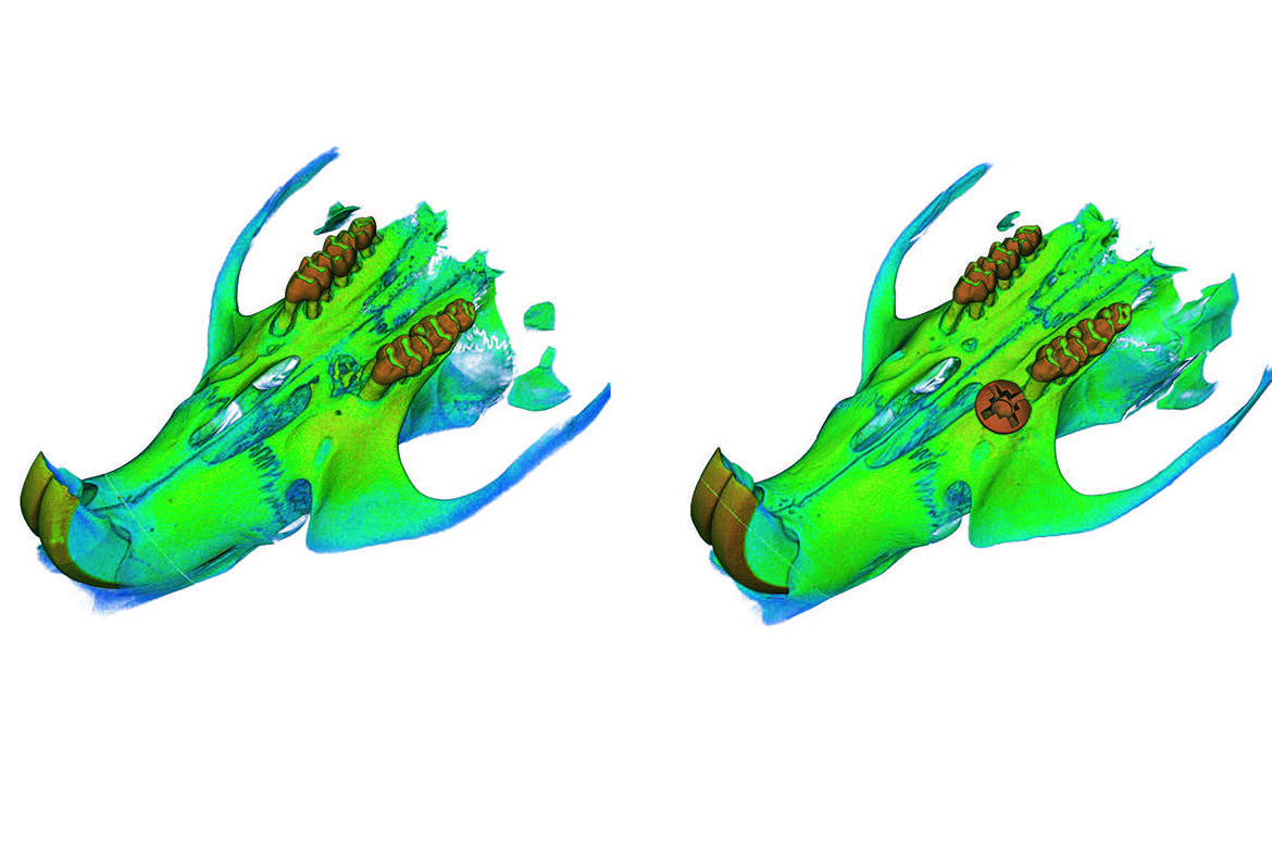 Implant versus hydrogel