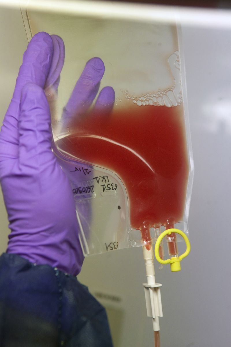 Got COVID19 antibodies? Donate blood and find out UCLA