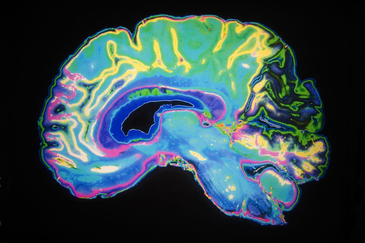 Colorful image of brain