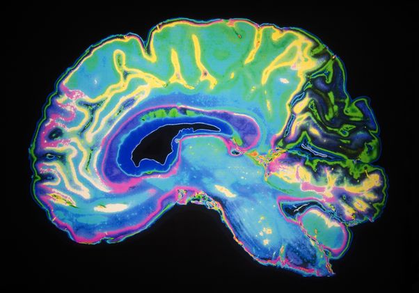 Colorful image of brain
