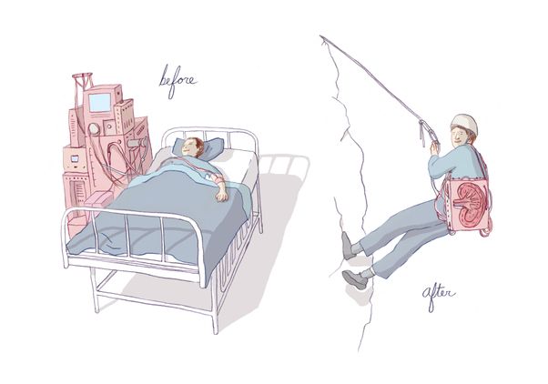 Portable Kidney