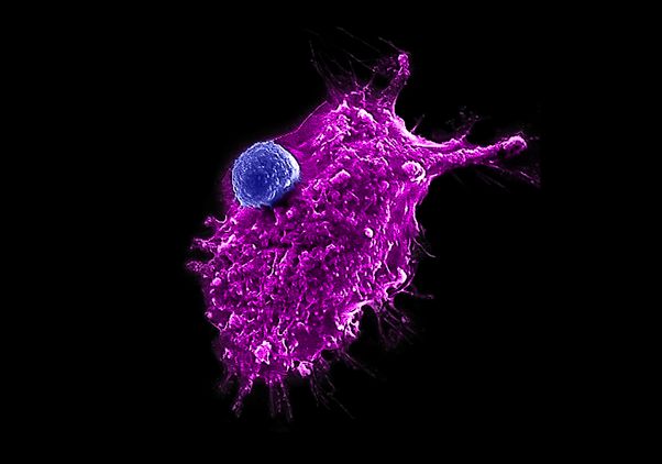 iNKT cell attacking a cancer cell