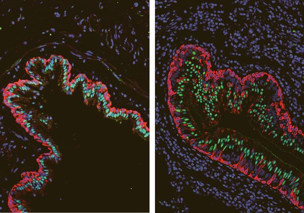Side-by-side comparison