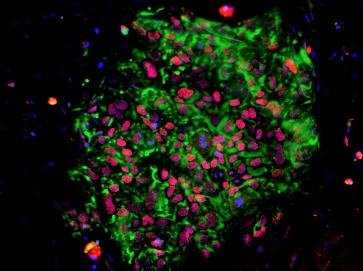 A colony of human induced pluripotent stem cells