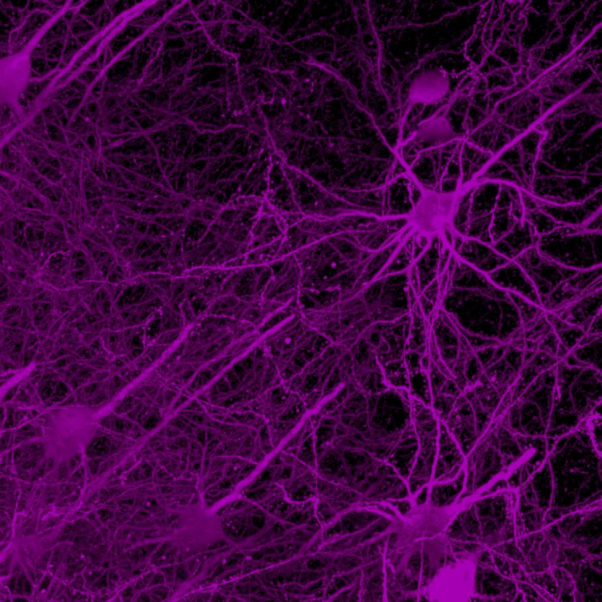 Neurons in a key circuit
