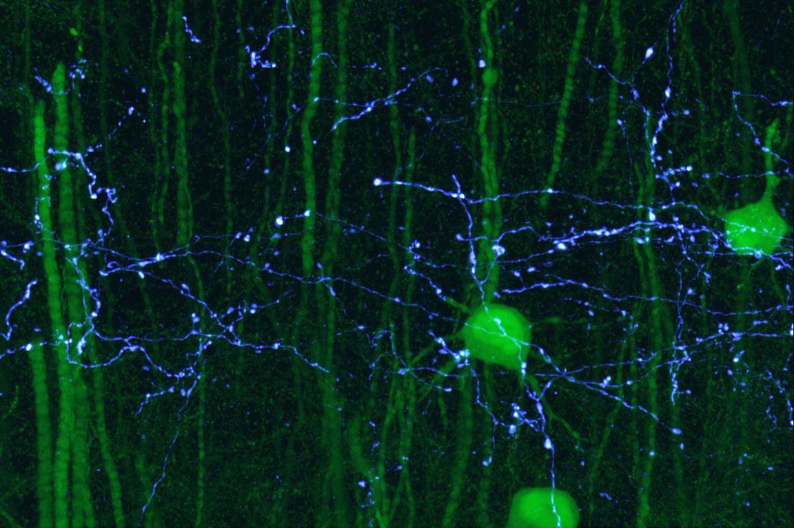 Science Mouse Neural Network UCLA study maps major circuit in the mouse brain | UCLA