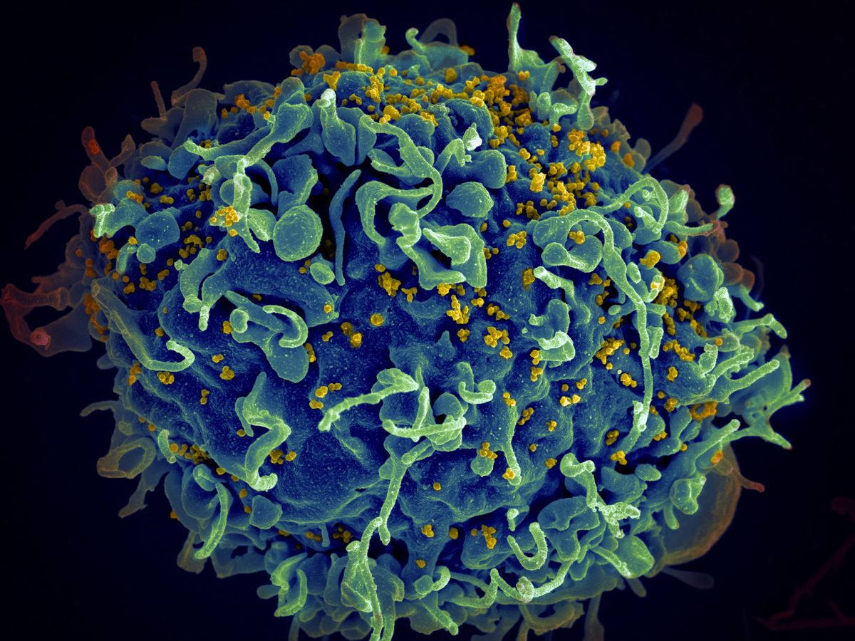 HIV attacks T cell 