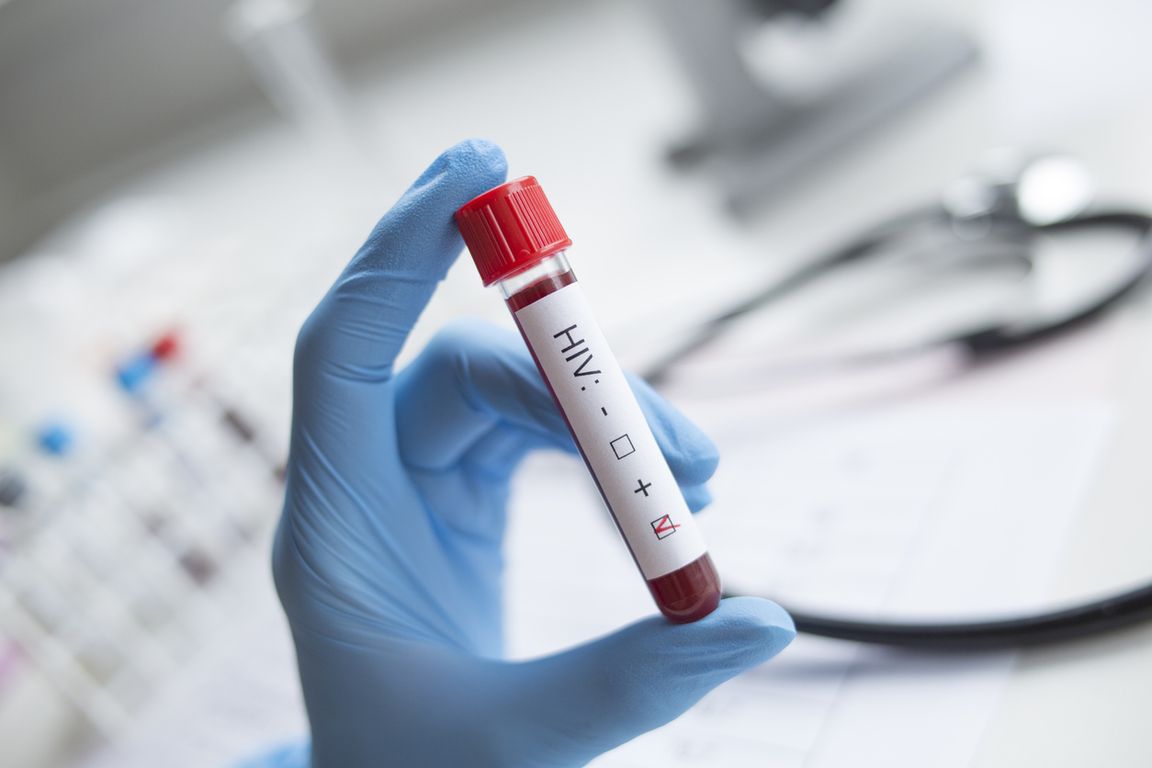 Gloved hand holding vial of blood marked ‘HIV’