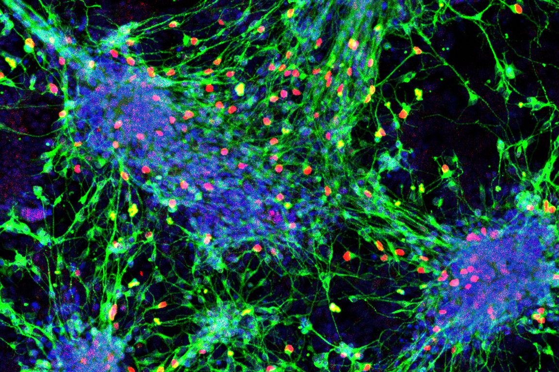 Scientists develop blueprint for turning stem cells into sensory interneurons - Vimarsana News
