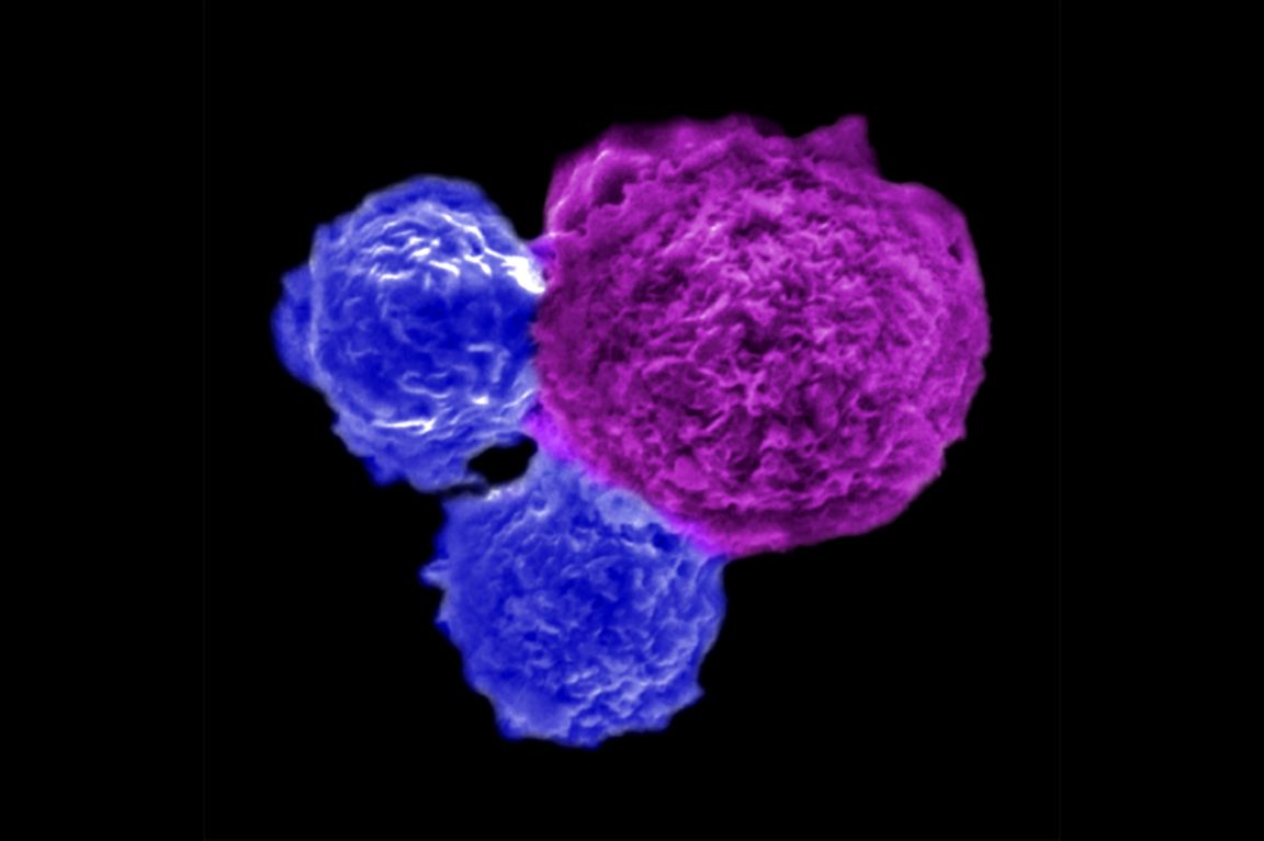 Cell therapy could improve bone marrow transplant safety - Vimarsana News