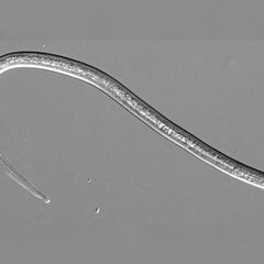 Black and white microscopic image of a single elongated nematode worm against a gray background.