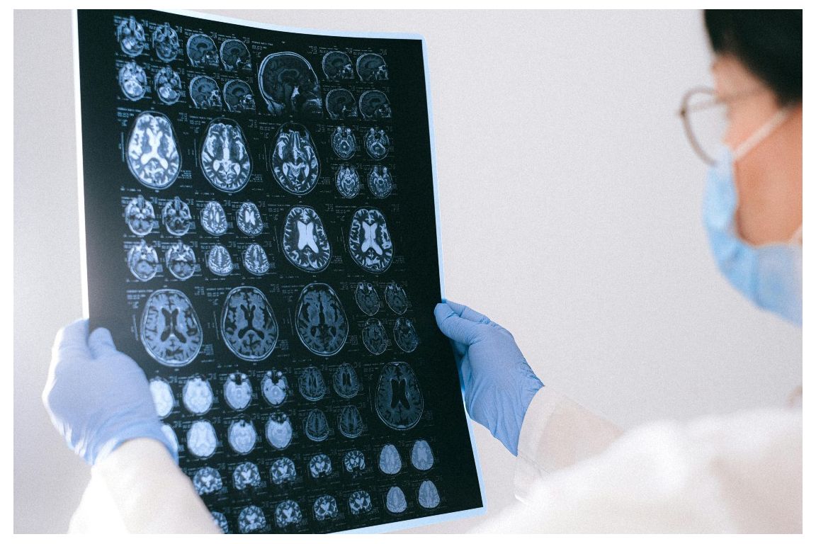Brain MRI