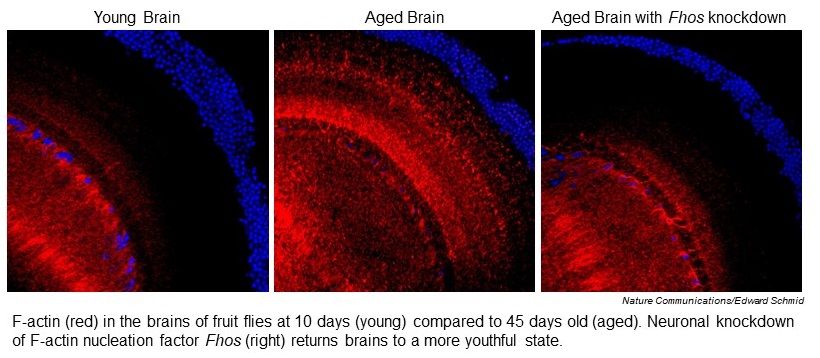 Three microscopy images of F-actin in brains of young and old fruit flies