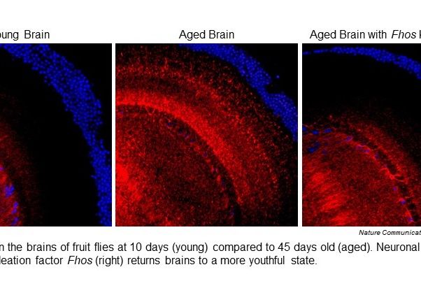 Three microscopy images of F-actin in brains of young and old fruit flies